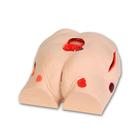 Seymour II Wound Care Model