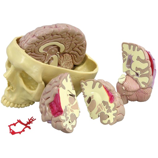 [A3B1019542] Brain Model